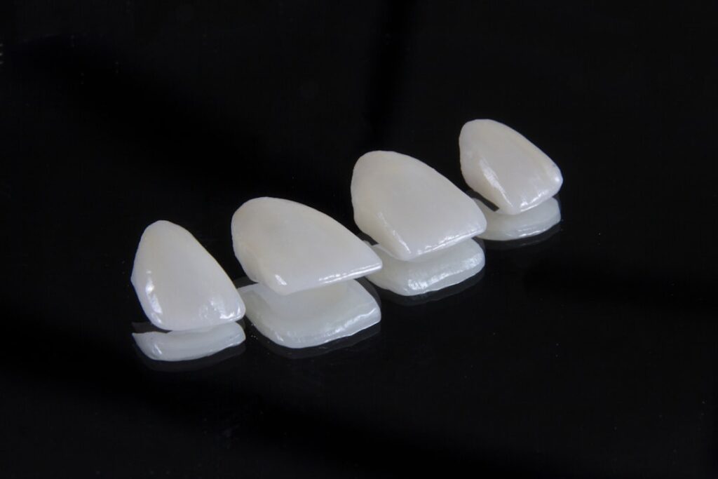 Porcelain Chip Fix: Complete Guide for Homeowners