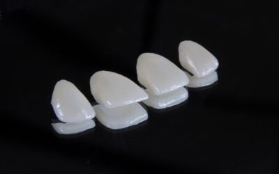 Porcelain Chip Fix: Complete Guide for Homeowners