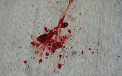 Get Rid of Blood Stains: A Complete Guide for Homeowners